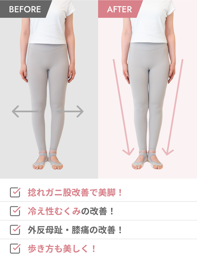 before after O脚